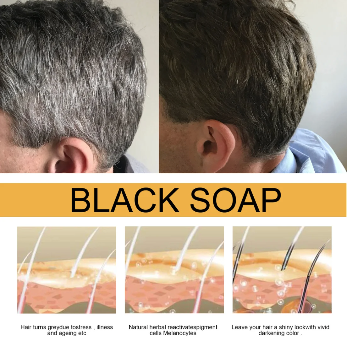 BLACK SOAP(Newly upgraded new packaging)