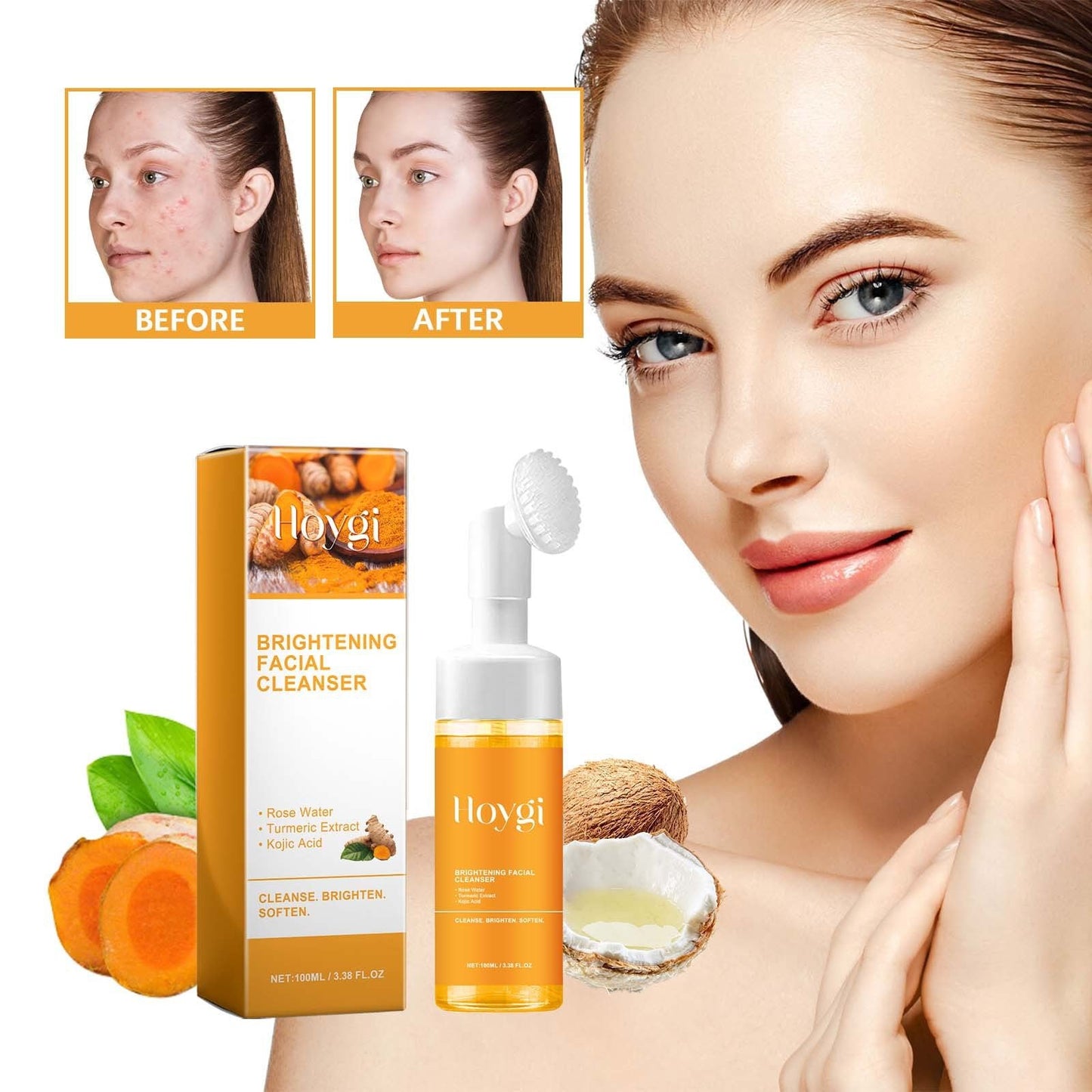 Turmeric Facial Cleanser for Acne & Marks - Deep Cleansing & Brightening