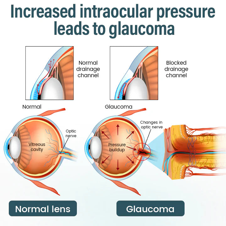 Timilk® OptiFusion Nano Eye Drops Serum (A)